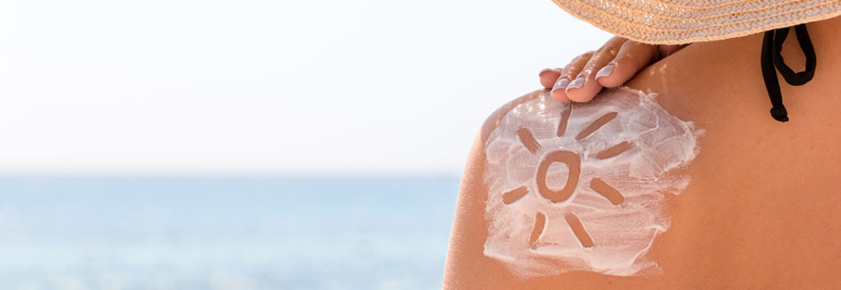 Hat dir die Sonne zu sehr gelacht? Diese Hausmittel helfen bei Sonnenbrand